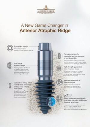 ARi® Implant – Stability Beyond Bone Loss