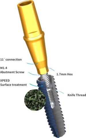 MiNi™ Implant – Small Diameter. Big Confidence